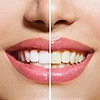 Природно белење на забите дома што вреди да се испроба